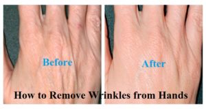 How to Remove Wrinkles from Hands